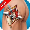Icona di Hip Surgery